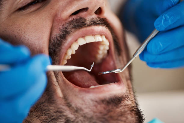 Dental Inlays and Onlays in Jacobus, PA